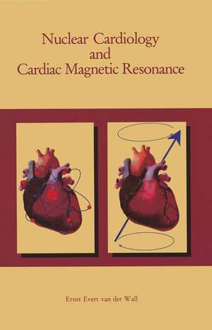 Nuclear Cardiology and Cardiac Magnetic Resonance: Physiology, Techniques and Applications de Ernst E. van der Wall