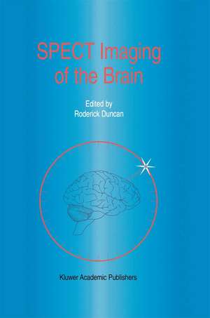 SPECT Imaging of the Brain de R. Duncan