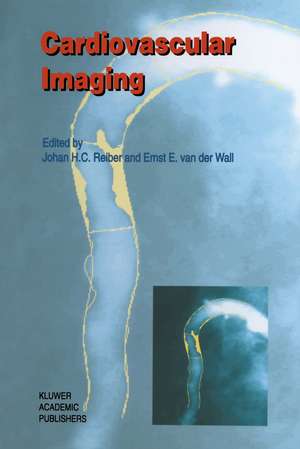 Cardiovascular Imaging de Johan H. C. Reiber