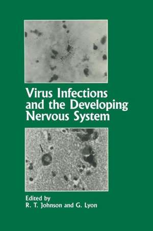 Virus Infections and the Developing Nervous System de R.T. Johnson