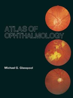 Atlas of Ophthalmology de M.G. Glasspool