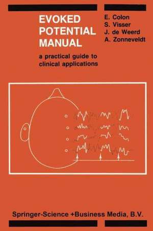 Evoked Potential Manual: A Practical Guide to Clinical Applications de E. Colon