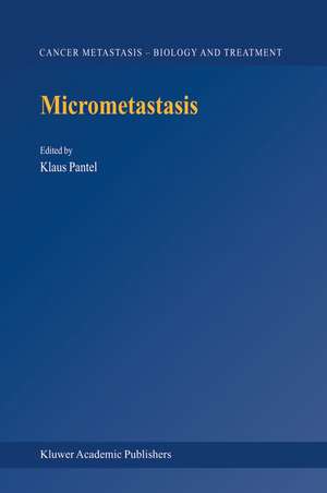 Micrometastasis de Klaus Pantel