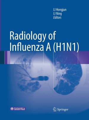 Radiology of Influenza A (H1N1) de Hongjun Li