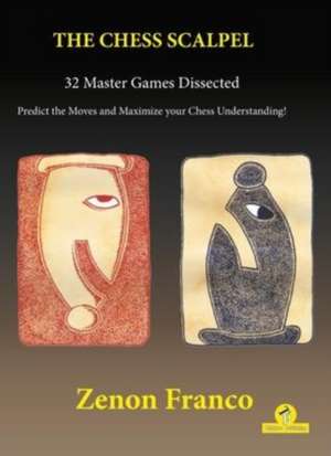 The Chess Scalpel - 32 Master Games Dissected de Franco