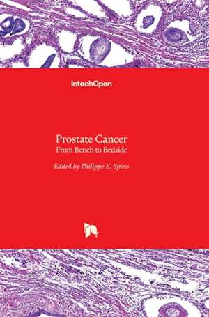Prostate Cancer de Philippe E. Spiess