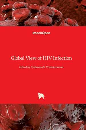 Global View of HIV Infection de Vishwanath Venketaraman