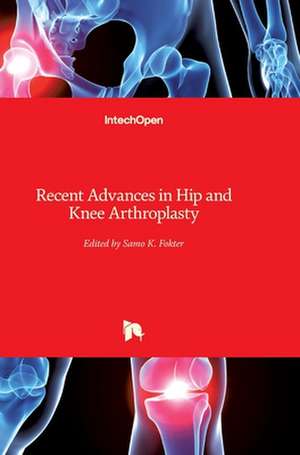 Recent Advances in Hip and Knee Arthroplasty de Samo Fokter