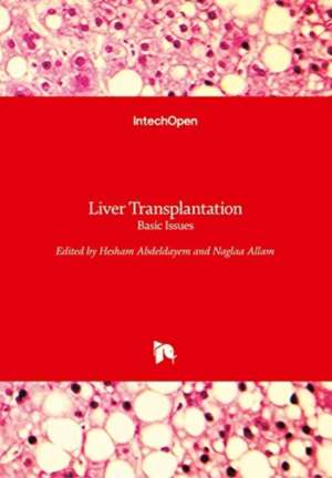 Liver Transplantation de Hesham Abdeldayem