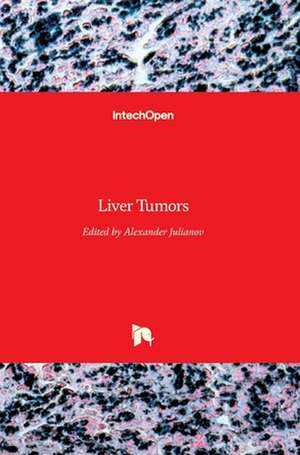 Liver Tumors de M. D. Julianov