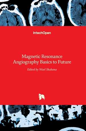 Magnetic Resonance Angiography de Wael Shabana