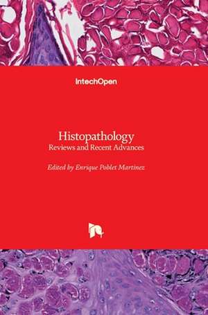 Histopathology de Enrique Poblet