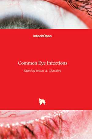 Common Eye Infections de Imtiaz Chaudhry