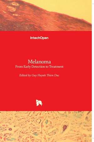 Melanoma de Guy Huynh Thien Duc