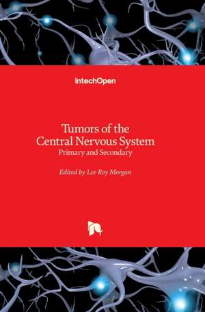 Tumors of the Central Nervous System de Lee Roy Morgan