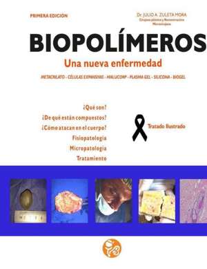 Biopolimeros: Una nueva enfermedad de Julio Alberto Zuleta Mora