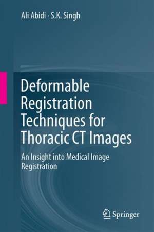 Deformable Registration Techniques for Thoracic CT Images: An Insight into Medical Image Registration de Ali Imam Abidi