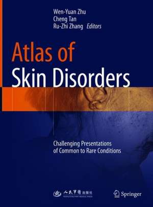 Atlas of Skin Disorders: Challenging Presentations of Common to Rare Conditions de Wen-Yuan Zhu