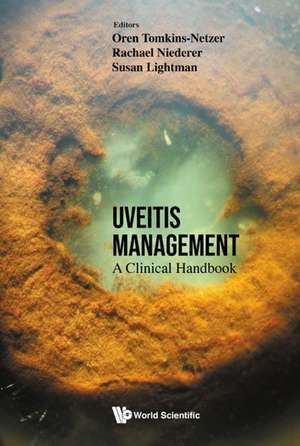 UVEITIS MANAGEMENT de Rachael Niederer & Oren Tomkins-Netzer