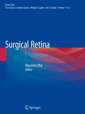 Surgical Retina de Masahito Ohji