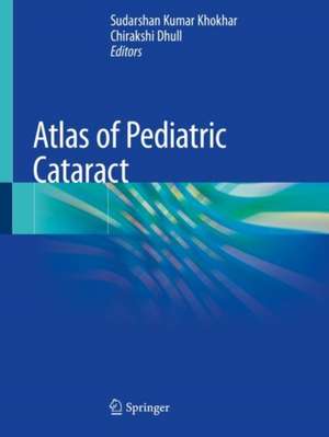 Atlas of Pediatric Cataract de Sudarshan Kumar Khokhar