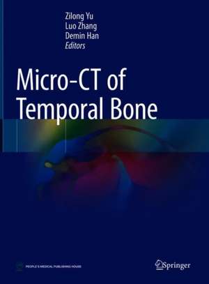 Micro-CT of Temporal Bone de Zilong Yu