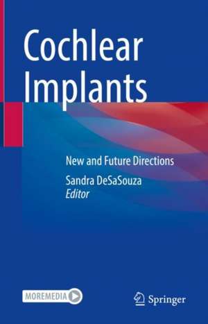 Cochlear Implants: New and Future Directions de Sandra DeSaSouza