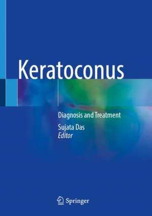 Keratoconus: Diagnosis and Treatment de Sujata Das