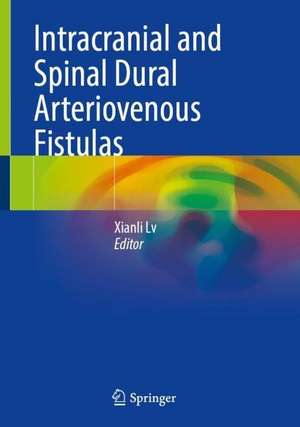 Intracranial and Spinal Dural Arteriovenous Fistulas de Xianli Lv