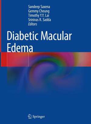 Diabetic Macular Edema de Sandeep Saxena