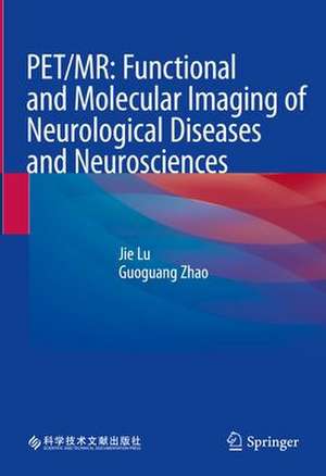 PET/MR: Functional and Molecular Imaging of Neurological Diseases and Neurosciences de Jie Lu