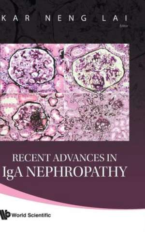 Recent Advances in IGA Nephropathy: A Finite/Infinite Element Approach de Kar Neng Lai