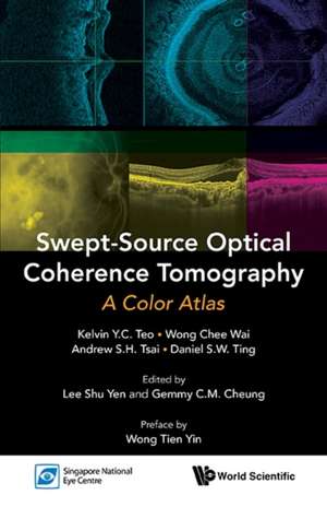 Swept-Source Optical Coherence Tomography de Kelvin Y. C. Teo