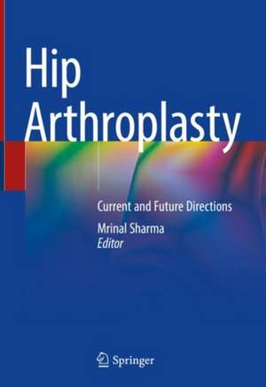 Hip Arthroplasty: Current and Future Directions de Mrinal Sharma