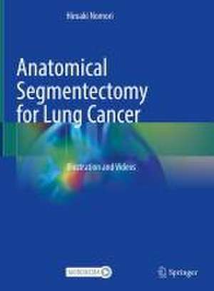 Anatomical Segmentectomy for Lung Cancer: Illustration and Videos de Hiroaki Nomori