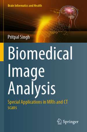 Biomedical Image Analysis de Pritpal Singh