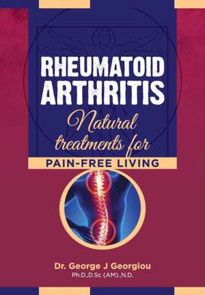 Rheumatoid Arthritis de George John Georgiou