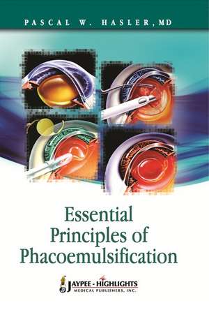 Essential Principles of Phacoemulsification de Pascal W Hasler