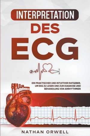 Interpretation des EKG de Nathan Orwell