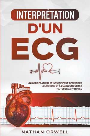 Interprétation d'un ECG de Nathan Orwell