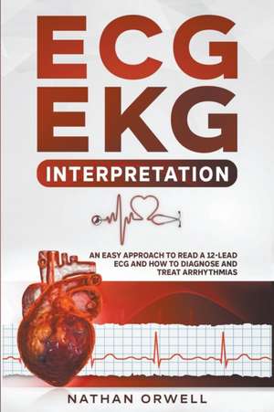 ECG/EKG Interpretation de Nathan Orwell