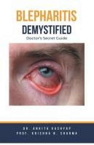 Blepharitis Demystified de Ankita Kashyap