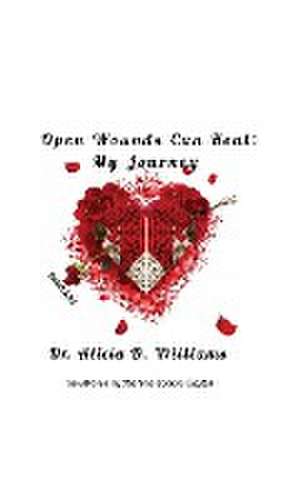 Open Wounds Can Heal de Alicia D. Williams