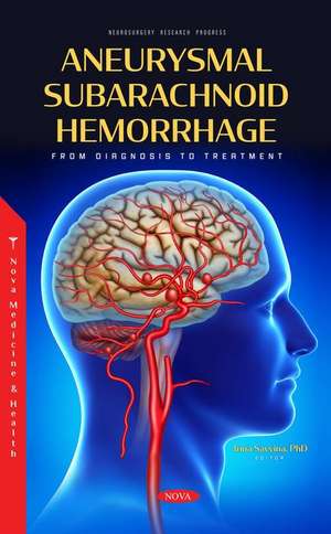 Aneurysmal Subarachnoid Hemorrhage: From Diagnosis to Treatment de Irina Alexandrovna Savvina