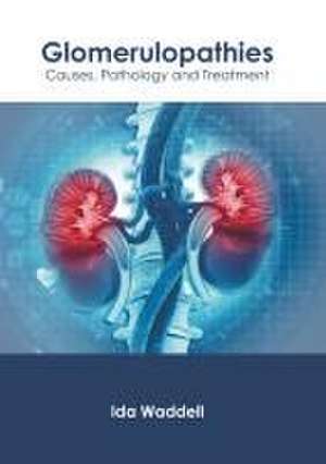 Glomerulopathies: Causes, Pathology and Treatment de Ida Waddell