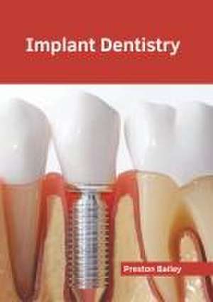 Implant Dentistry de Preston Bailey