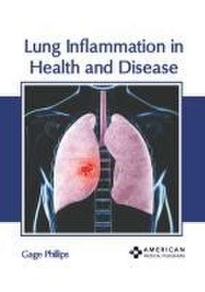 Lung Inflammation in Health and Disease de Gage Phillips