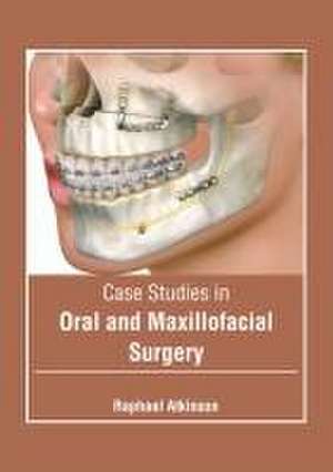 Case Studies in Oral and Maxillofacial Surgery de Raphael Atkinson