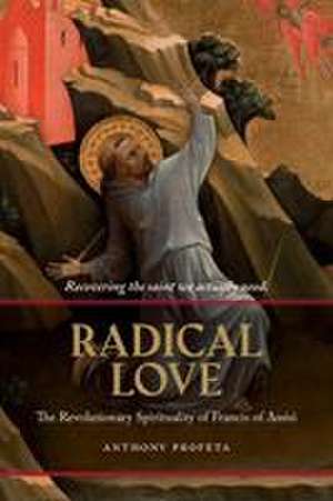 Radical Love de Anthony Profeta