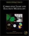 Correlative Light and Electron MIcroscopy